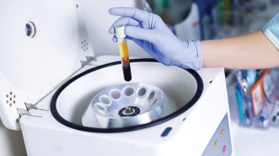 Pengertian dan Fungsi Centrifuge di Laboratorium Biologi